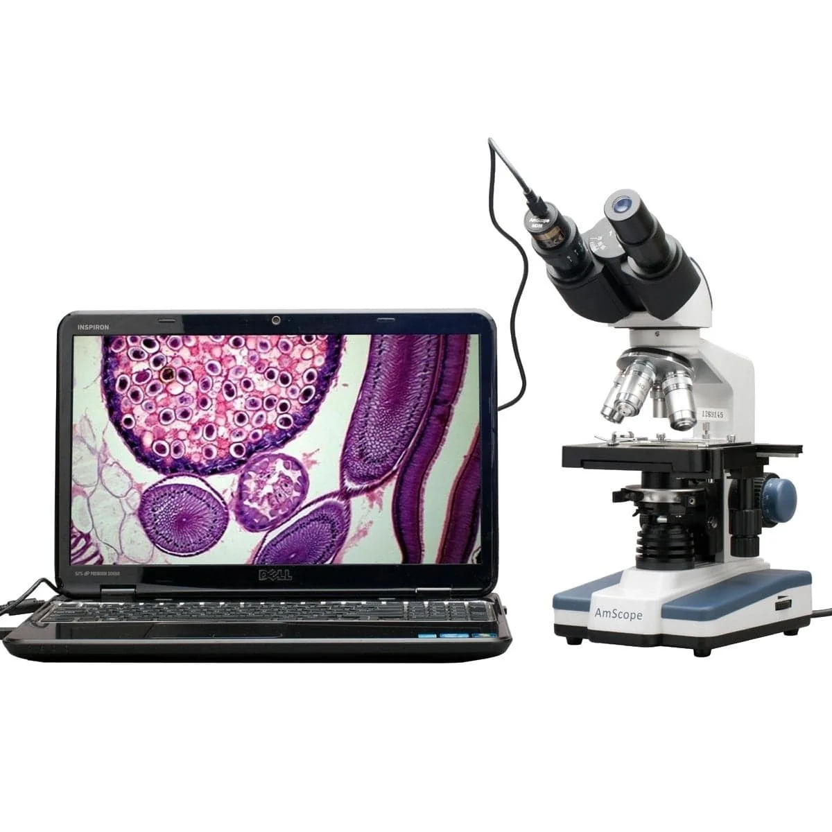 AmScope B120 Series Binocular Compound Microscope 40X-1600X Magnification with LED, Siedentopf Head and 5MP Digital Camera