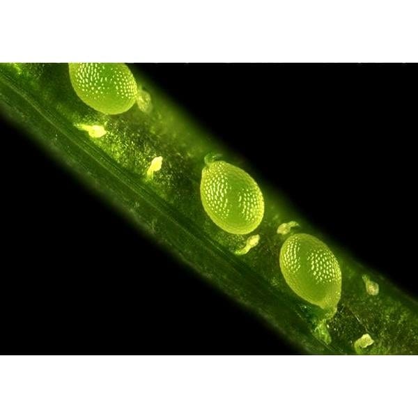 AmScope IN300 Series Inverted Phase-Contrast Biological EPI-Fluorescent Trinocular Compound Microscope with 30W Halogen Optional Color CCD Digital Camera - Image 10