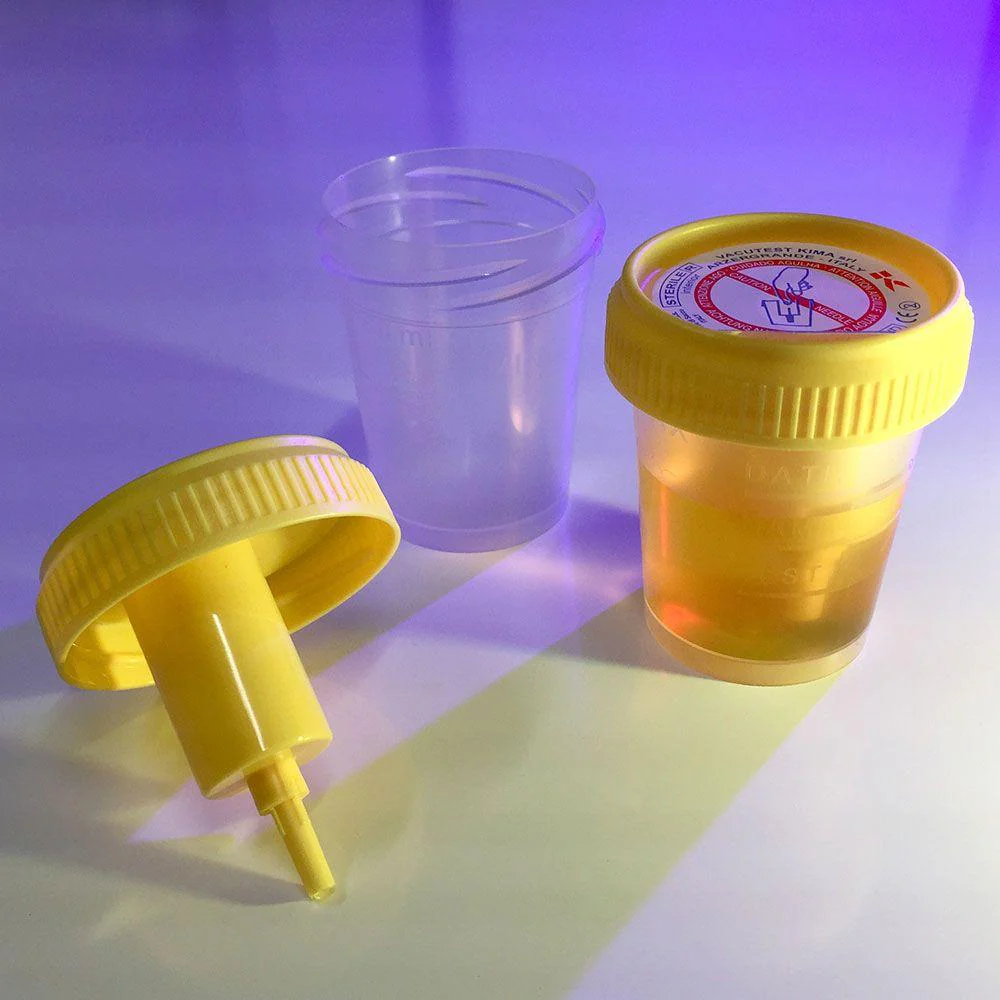 Globe Scientific Urine Collection Cup with Integrated Transfer Device, 2oz (60mL), STERILE, Individually Wrapped, Cs/500