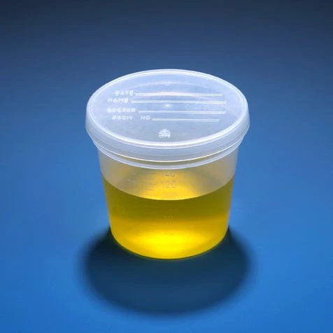 Globe Scientific Specimen Container, 5oz. with Separate Snap Cap, PP, Graduated, Cs/300
