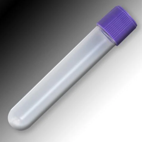 Globe Scientific Self-Standing Polypropylene Sample Tube w/Round or Conical Bottom - Image 5