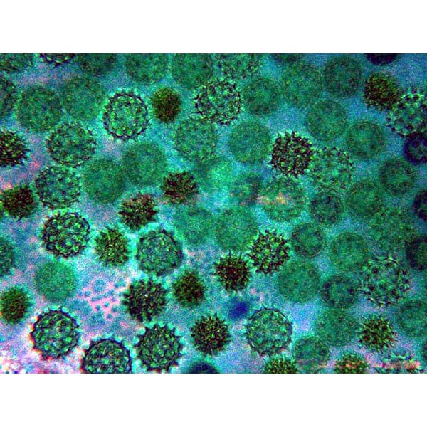 AmScope IN300 Series Infinity-corrected Inverted Biological Trinocular Compound Microscope 40X-800X Magnification with Phase-contrast - Image 8