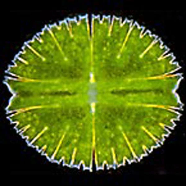 AmScope IN480 Series Inverted Infinity-corrected Phase-contrast Trinocular Compound Microscope 40X-1500X Magnification with Koehler Illumination and 5MP CCD Camera - Image 8
