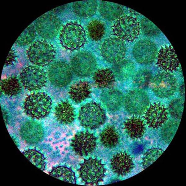 AmScope M400 Seriec Clinical Biological Monocular Compound Microscope 40X-800X Magnification with Mech. Stage - Image 2