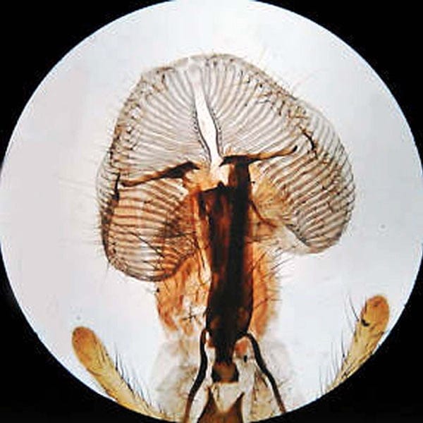 AmScope SE305 Series Compact Multi-Lens Binocular Stereo Microscope 10X-60X Magnification with Angled Head, Metal Pillar Stand, Top & Bottom Halogen Lighting, 1MP Digital Eyepiece Camera - Image 8