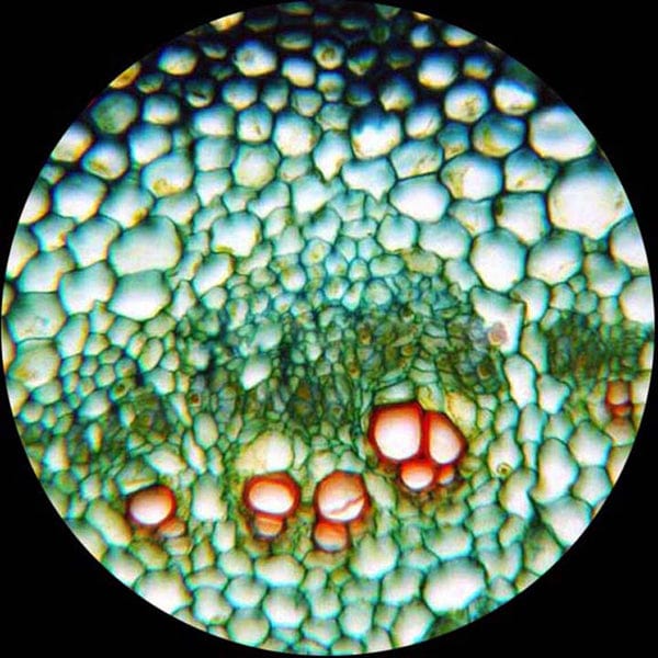 AmScope T340 Series Siedentopf Trinocular Compound Microscope 40X-2000X Magnification with 5MP Digital Camera - Image 7
